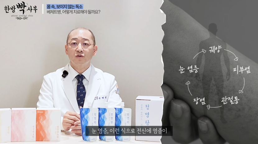 베체트병 진단