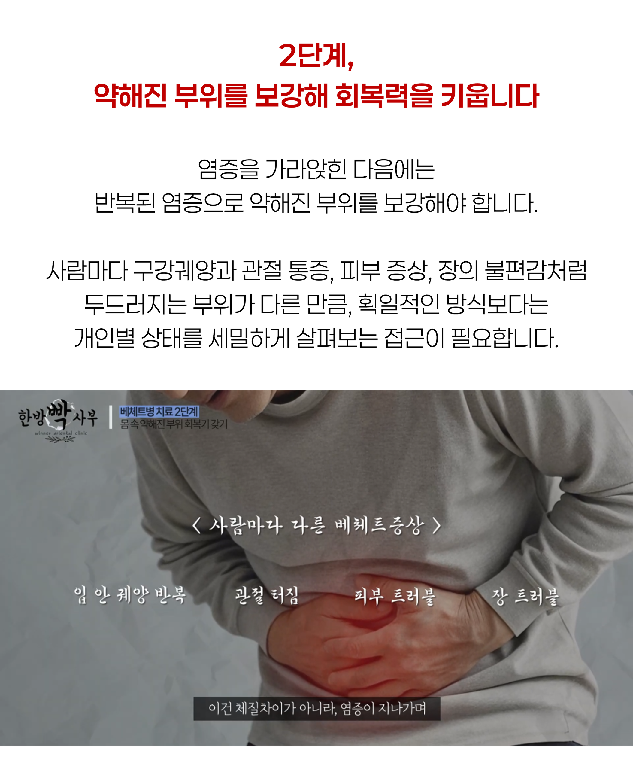 베체트병11