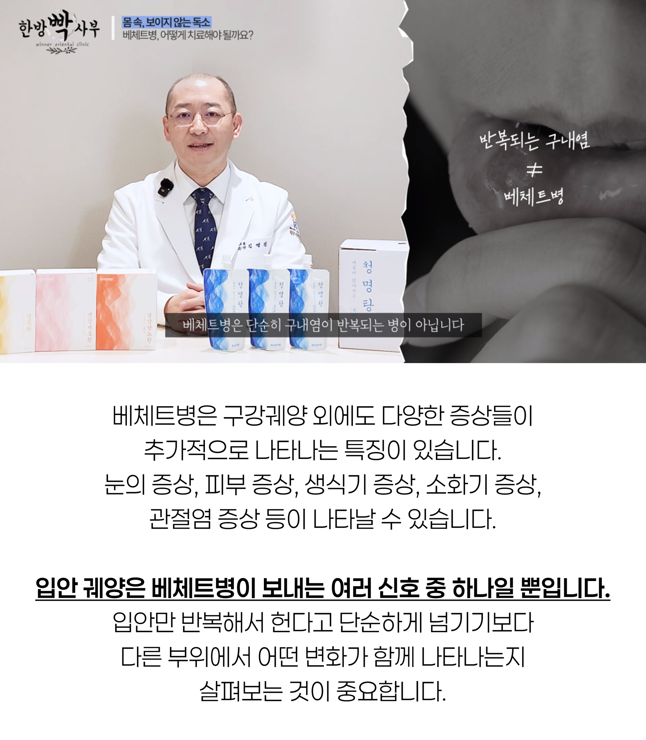 베체트병3