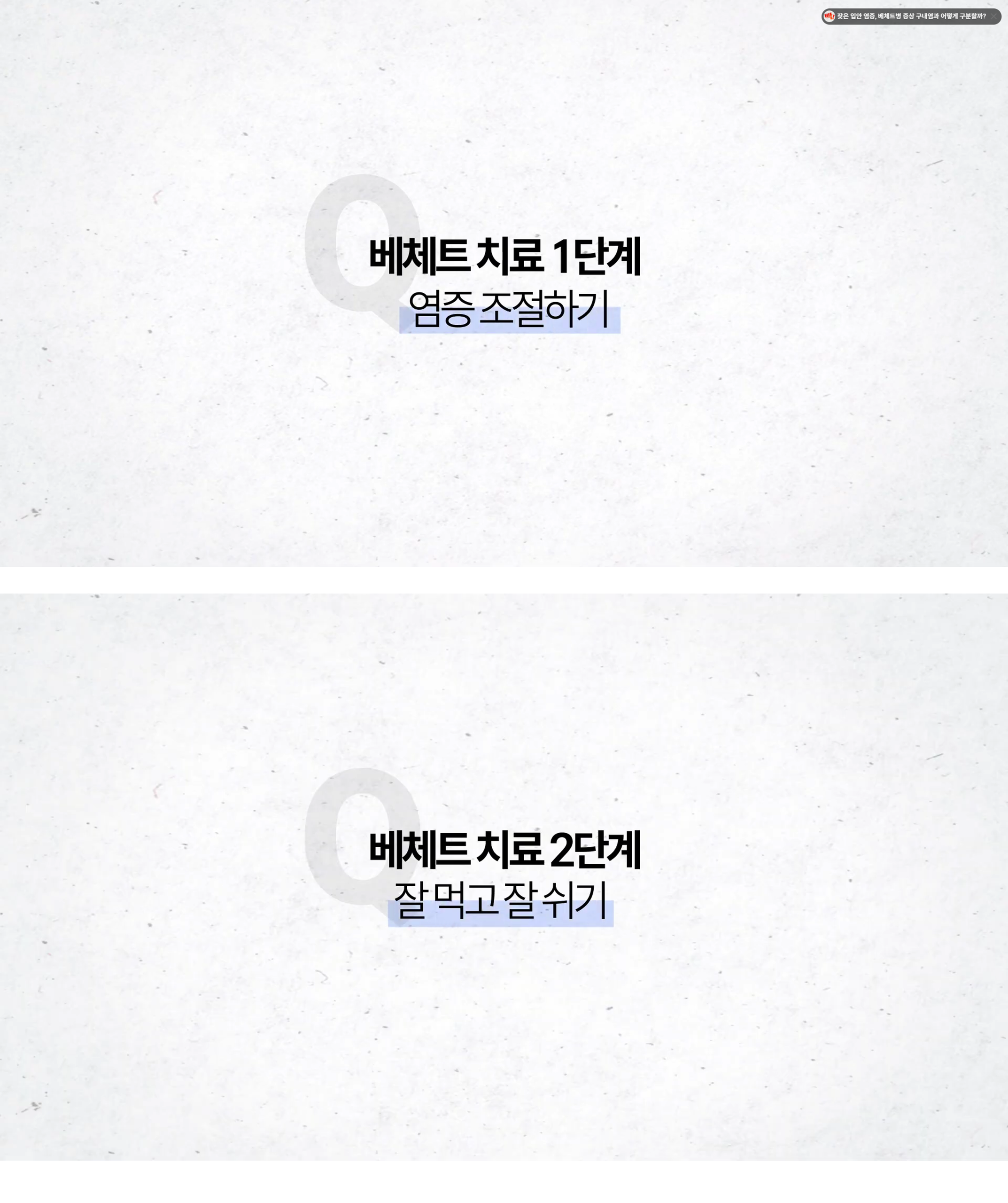 베체트병8